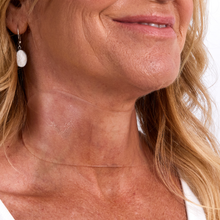 Load image into Gallery viewer, Neck Wrinkle Patch — Medical Grade Silicone Anti-Wrinkle Treatment