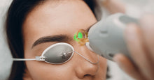 Load image into Gallery viewer, Laser Genesis Laser Facial